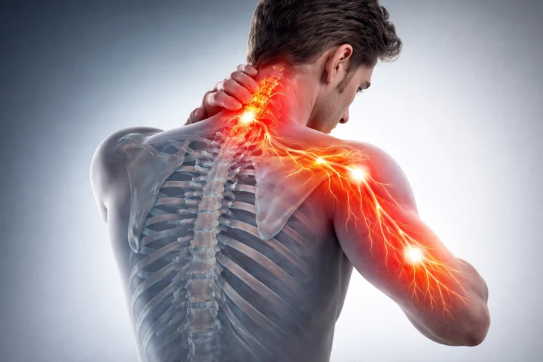 Neck pain causing arm pain explained