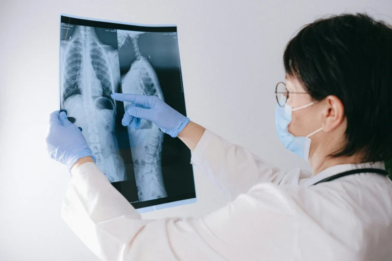 Recovery Timeline After Kyphoplasty