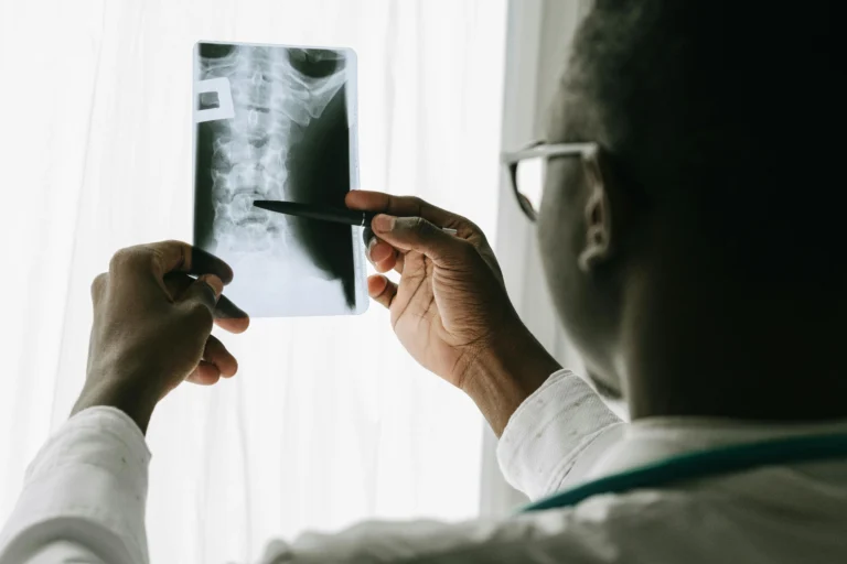 What Is Kyphoplasty and How It Works?
